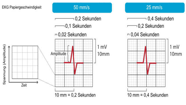 Die EKG-Ableitungen: Elektroden, Extremitätenableitungen, Brustwandableitungen, 12-Kanal-EKG