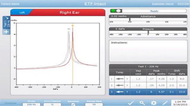 EUSTACHIAN TUBE FUNCTION