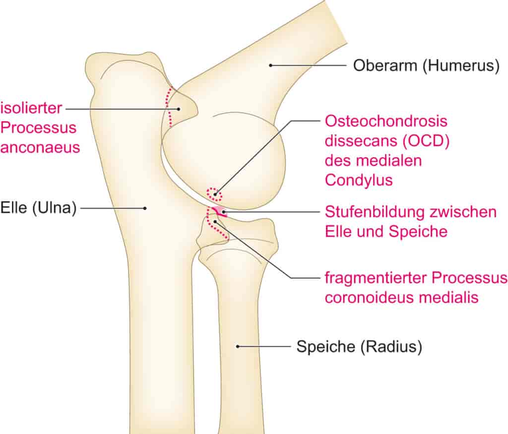 Die Ellenbogengelenksdysplasie (ED)