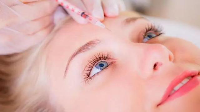 Frotox - die Alternative zu Botox