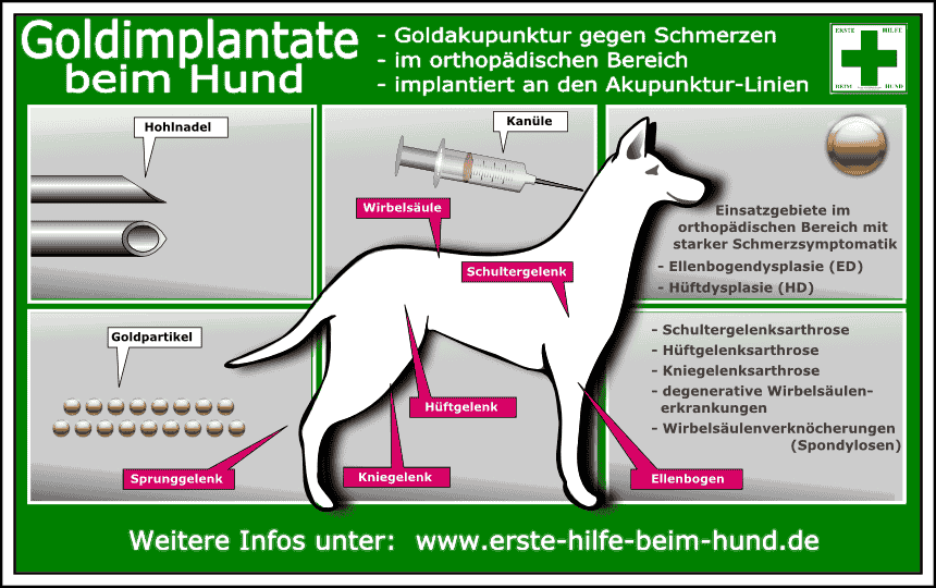 THERAPIE-CHECKLISTE : Gold-Implantate und Gold-Akupunktur