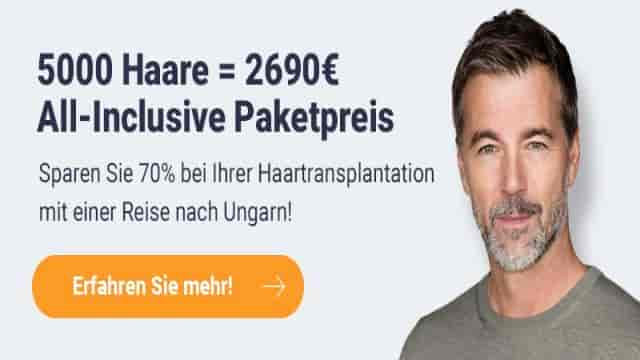 Haartransplantation in Deutschland: TOP 10 Kliniken im Jahr 2023