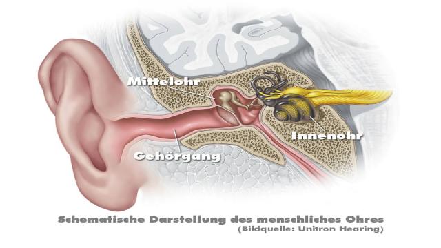 Welcher ist der stärkste Gehörschutz?