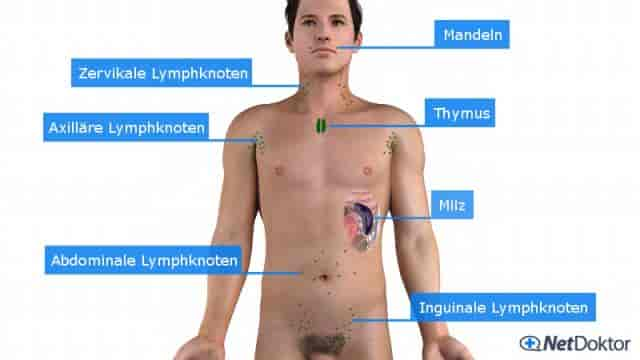 Geschwollene Lymphknoten