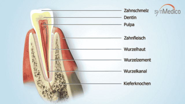 Wie wird eine Füllung gemacht? Arten, Ablauf und Kosten