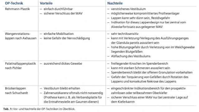 Verschluss einer persistierenden Mund-Antrum-Verbindung