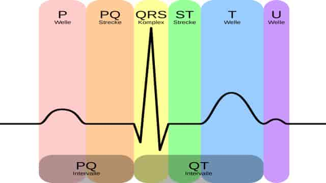 Ruhe-EKG